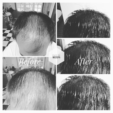 Center of Excellence in Pain   Regenerative Medicine | Interventional Pain Management, PRP Injection for Joint Pain and Vampire Facial and Facelift