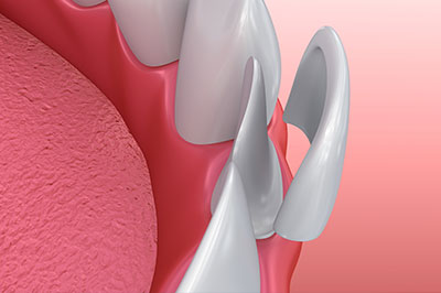 Center of Excellence in Pain   Regenerative Medicine | PRP Injection for Joint Pain, PRP for Hair Loss and O-shot